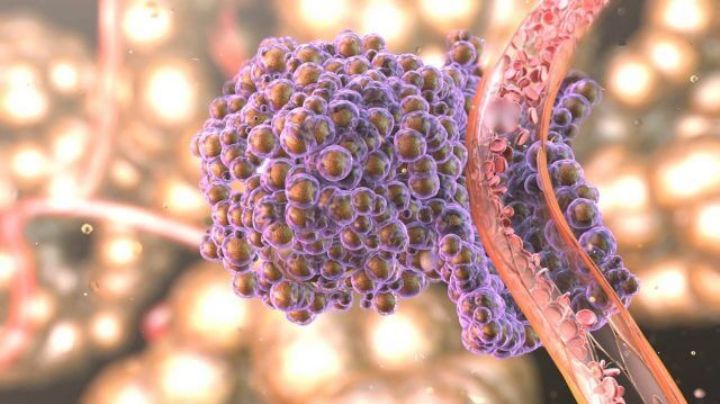 Convierten células cancerígenas en grasa para evitar metástasis