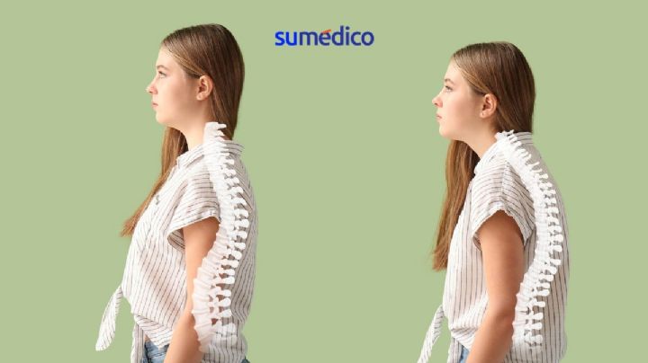 5 ejercicios que te ayudan a mejorar tu postura corporal