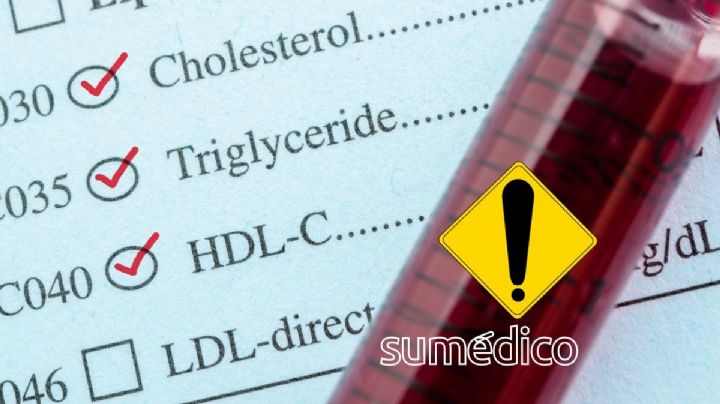 ¿Qué es más peligroso? ¿El colesterol alto o los triglicéridos altos?