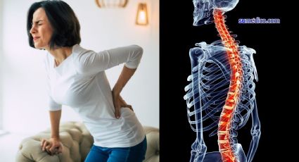 ¿Qué tipo de dolores son un signo de alerta de problemas en la columna? Experto da las claves