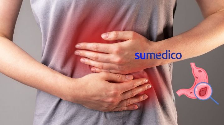 ¿Qué es el cáncer gástrico y cómo detectarlo?