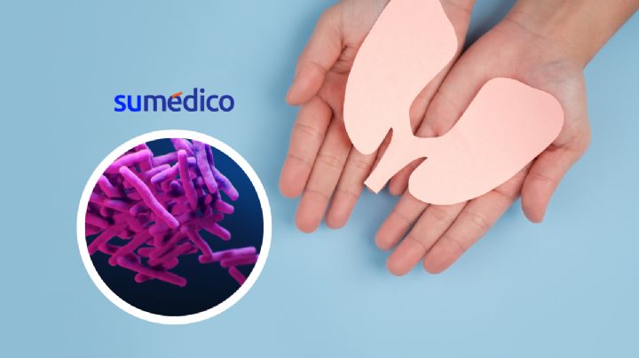 En América mueren cerca de 90 personas al día por tuberculosis ¿cómo prevenir?
