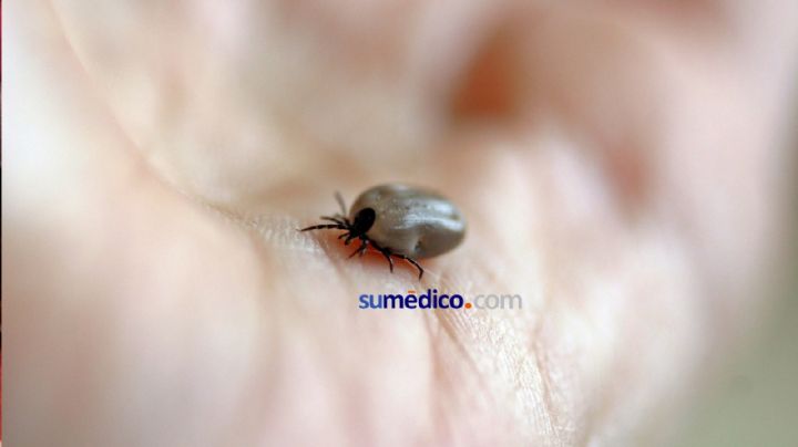 Enfermedades por garrapatas van en aumento, ¿Cómo cuidarse?