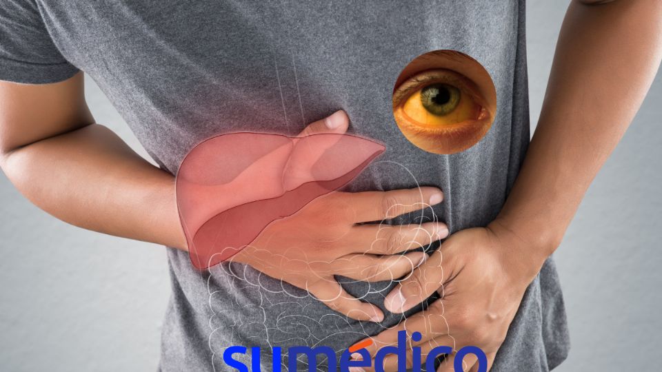 Es importante que conozcas los diferentes tipos de hepatitis.