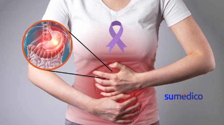 Factores clave para detectar cáncer de estómago