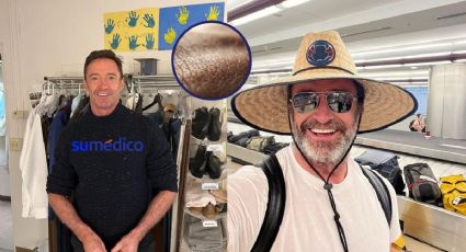 ¿Hugh Jackman tiene cáncer de piel? Esto sabemos