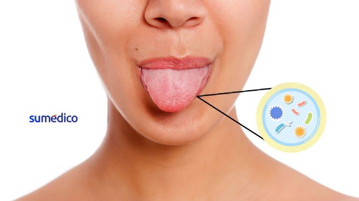 ¿Qué es la capa blanca que aparece en nuestra lengua y por qué se forma?