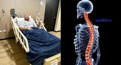 ¿En qué consiste la cirugía de columna que tuvo Latin Lover?