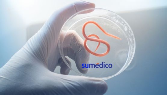 El caso del niño en Chiapas al que le extrajeron ¡142 lombrices!