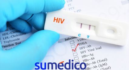 ¿Por qué es importante hacerse la prueba del VIH y dónde hacerla gratis en CDMX?