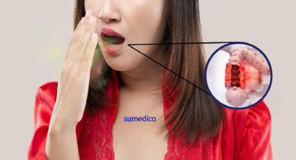 ¿Eructar mucho puede ser signo de cáncer? Te contamos