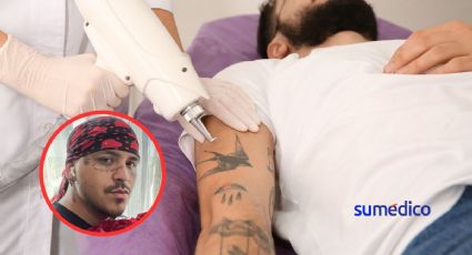 Christian Nodal: ¿Cómo será el procedimiento para remover los tatuajes de su cara?