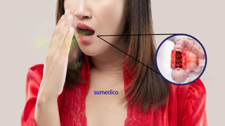 ¿Eructar mucho puede ser signo de cáncer? Te contamos
