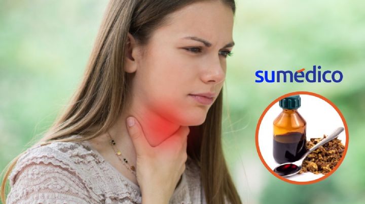¿Dolor de garganta? Estos son los beneficios y cuidados al consumir propóleo