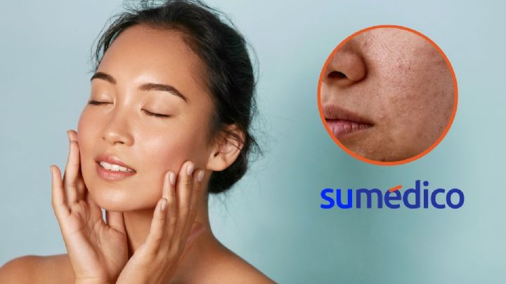 5 errores comunes que cometes en tu rutina diaria de cuidado facial