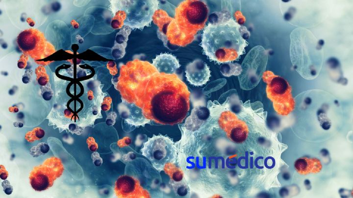¿Cómo es el implante cerebral biodegradable que ofrece medicamentos contra el cáncer?
