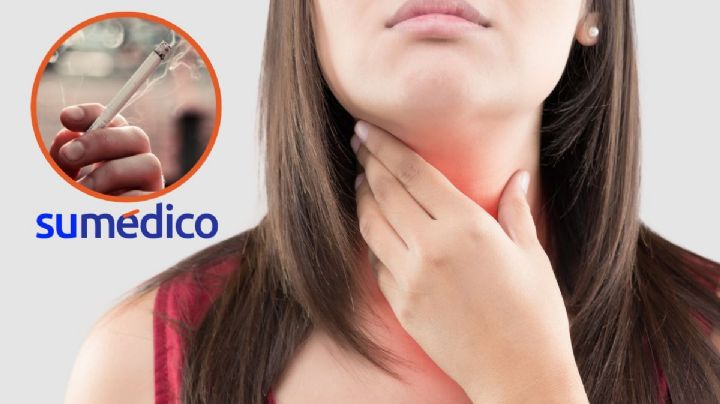 Tabaco y alcohol causan hasta el 70% de los cánceres de cabeza y cuello