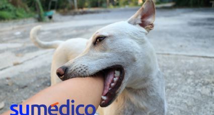 Enfermedades que los animales pueden transmitir a los humanos