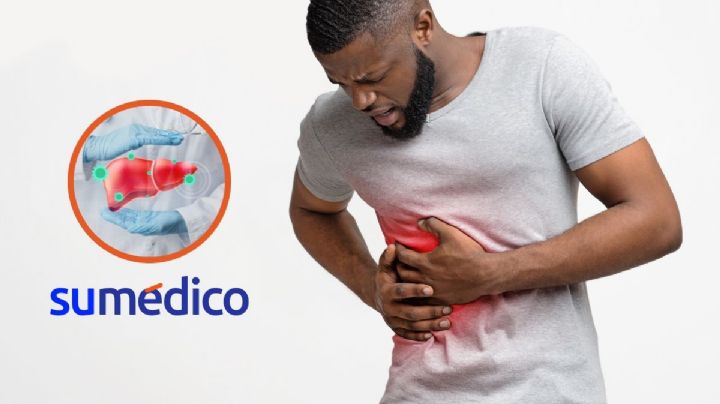 Proponen escala para identificar personas en riesgo de una enfermedad hepática
