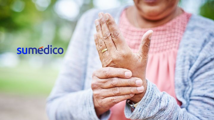 El diagnostico oportuno de la artritis evita el rápido deterioro de las articulaciones