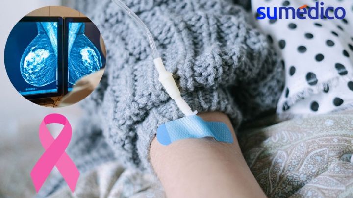 ¿La quimioterapia puede reactivar el cáncer de mama?