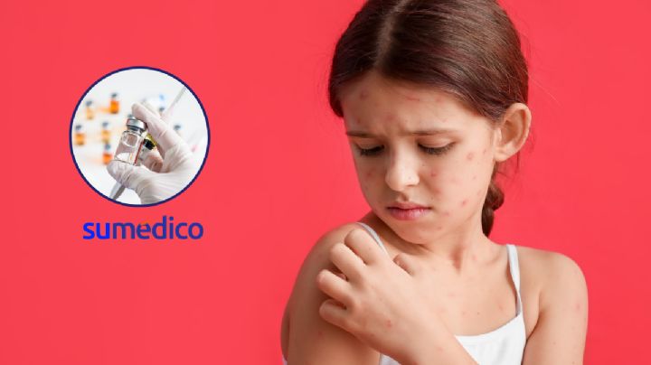 ¿Cuándo es buen momento para ponerle la vacuna de la varicela a mi hijo?
