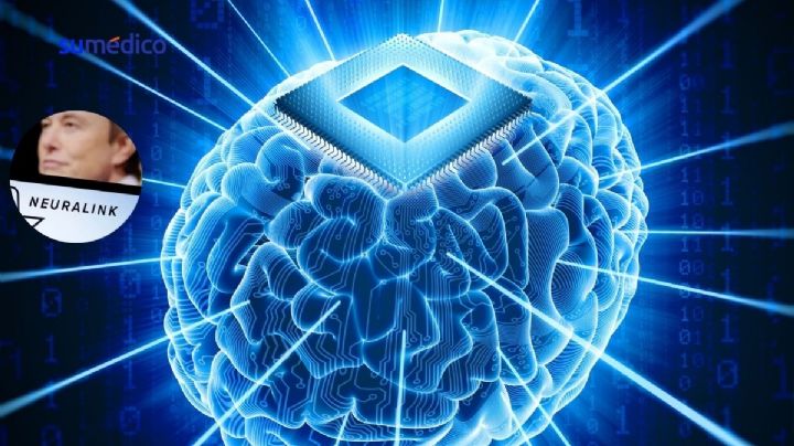 ¿Cómo funciona el primer implante cerebral creado por la empresa Neuralink de Elon Musk?