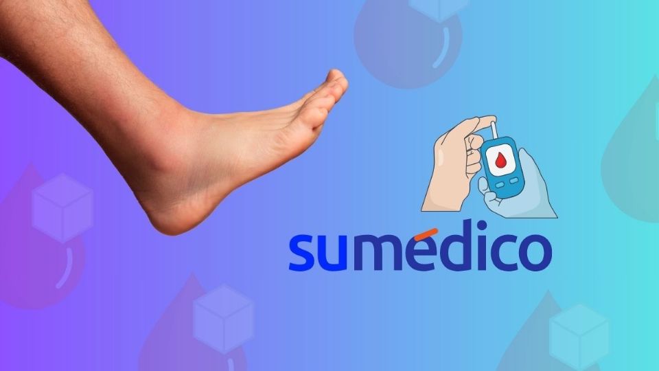 Así afecta la diabetes a los pies