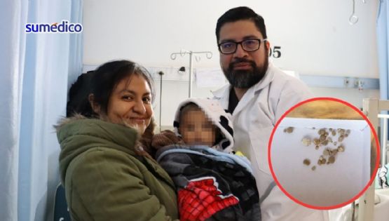 Así salvaron la vida a un bebé de 7 meses con piedras en los riñones