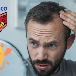 ¿Qué relación hay entre el colesterol alto y la alopecia?