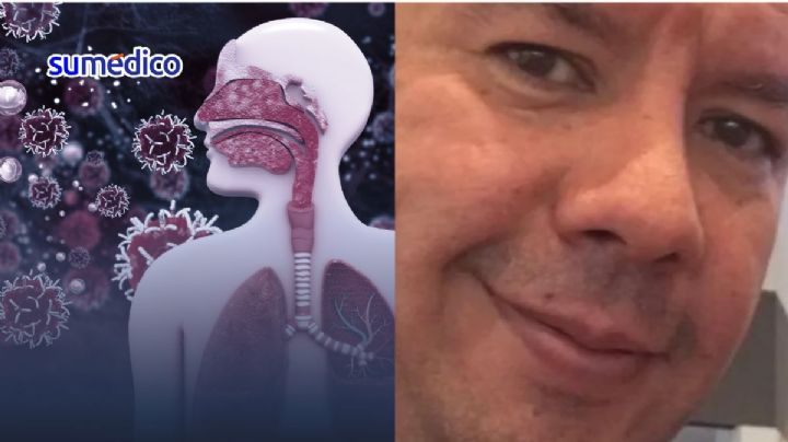 'Un hongo me causó infección en los pulmones y problemas para respirar'