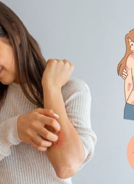 ¿Qué es la psoriasis y cómo afecta a la vida diaria de las personas?