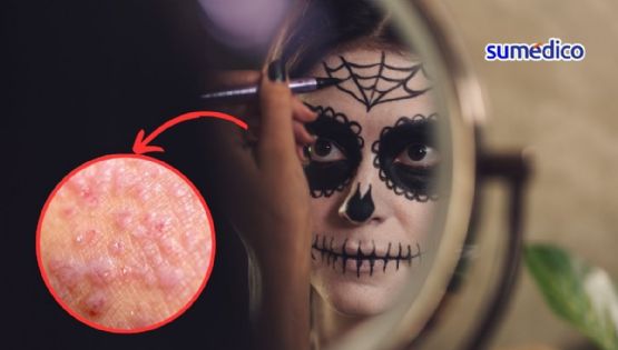 ¿Qué afección de la piel podría causar el maquillaje en Halloween y Día de Muertos?