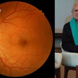 Así detectó Eric del Castillo que tenía degeneración macular: “Veía manchas raras”