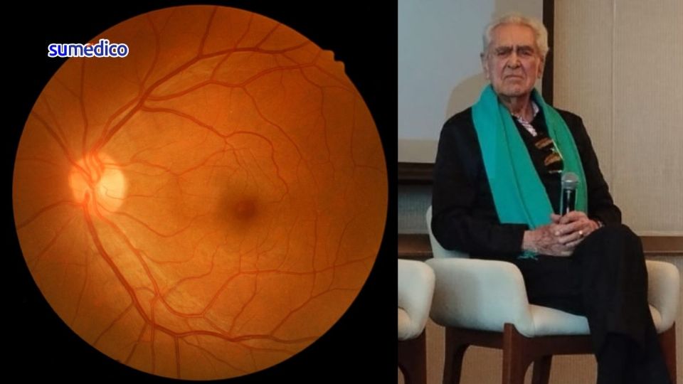 Eric del Castillo asegura que se sufre mucho con una enfermedad como la degeneración macular.