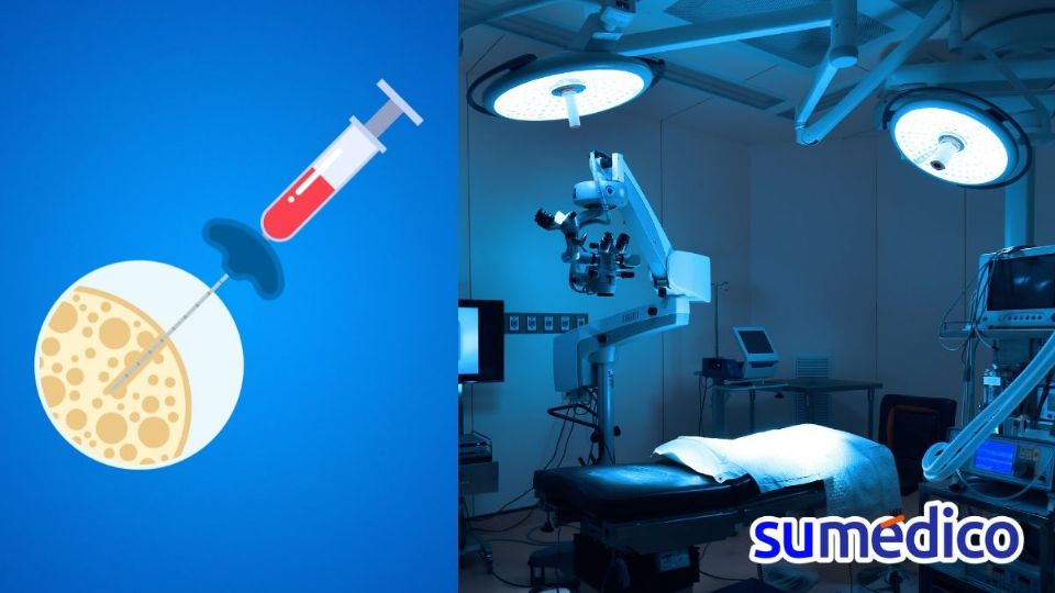 El Hospital Juárez de México realizó tres trasplantes de médula ósea simultáneamente