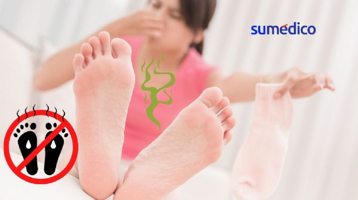 ¿Por qué te huelen mal los pies?
