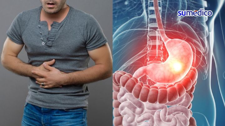 'Mi papá llevaba una vida saludable y fue diagnosticado con cáncer de estómago'