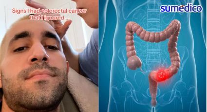 "Me diagnosticaron cáncer de colon en etapa 4, esto es lo que haría diferente"