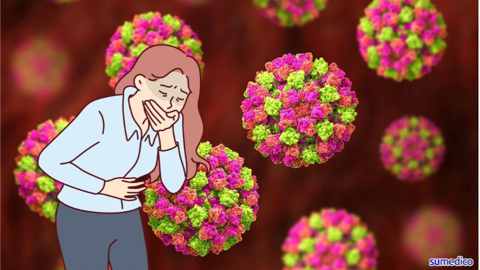 El norovirus es altamente contagioso, incluso después de que desaparecen los síntomas