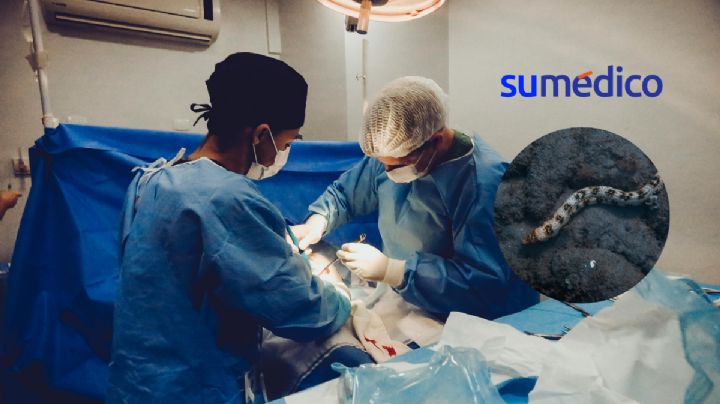 Médicos encuentran anguila en el abdomen de un hombre con fuertes dolores