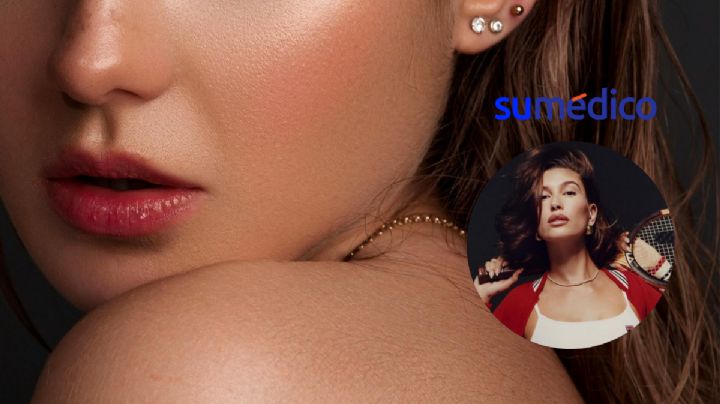 ¿Qué es la dermatitis perioral como la que padece Hailey Bieber?