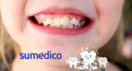 ¿Qué hacer si un niño tiene los dientes chuecos?