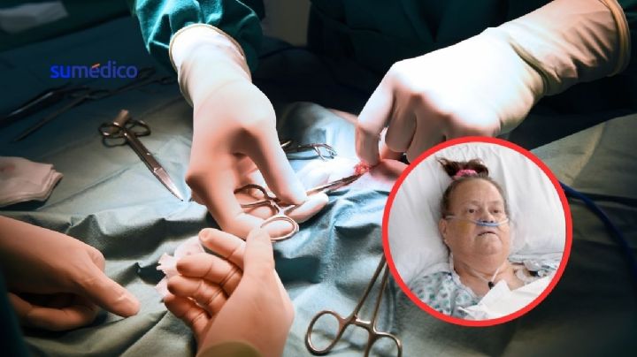 Combinan por primera vez un trasplante de riñón de cerdo y un dispositivo cardiaco
