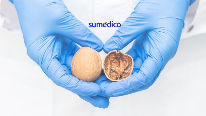 El cancer testicular tiene altas probabilidades de recuperación; la autoexploración es necesaria