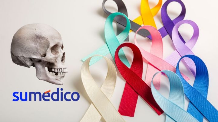 Así descubren primera operación de cáncer con ayuda de un cráneo
