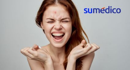 ¿Qué hacer para bajar la inflamación de un grano? 5 trucos que no conocías