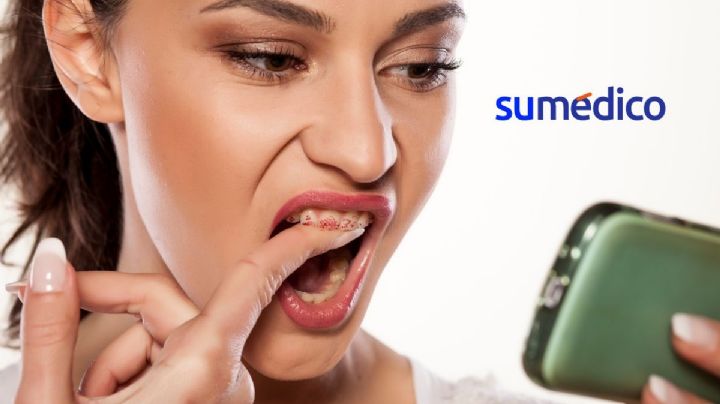 ¿Qué significa que te salgan manchas en los dientes?