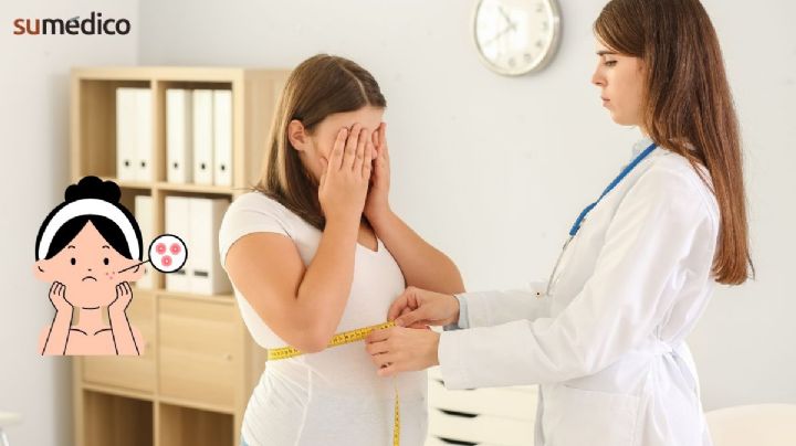 ¿Cómo afecta la obesidad a la piel de los niños?