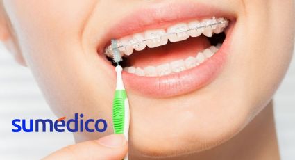 ¿Cómo cepillar mis dientes si tengo brackets?